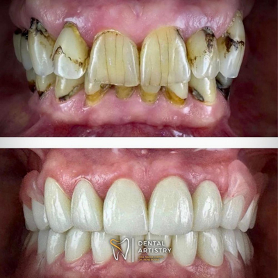 Slider image (1) Dental Artistry Dental Center